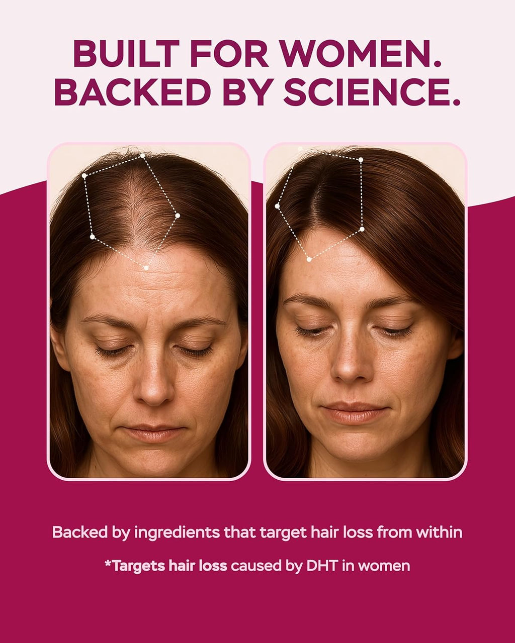 Improved Complex Saw Palmetto for Women 900 mg