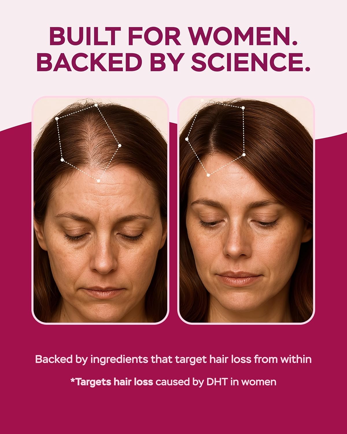 Improved Complex Saw Palmetto for Women 900 mg